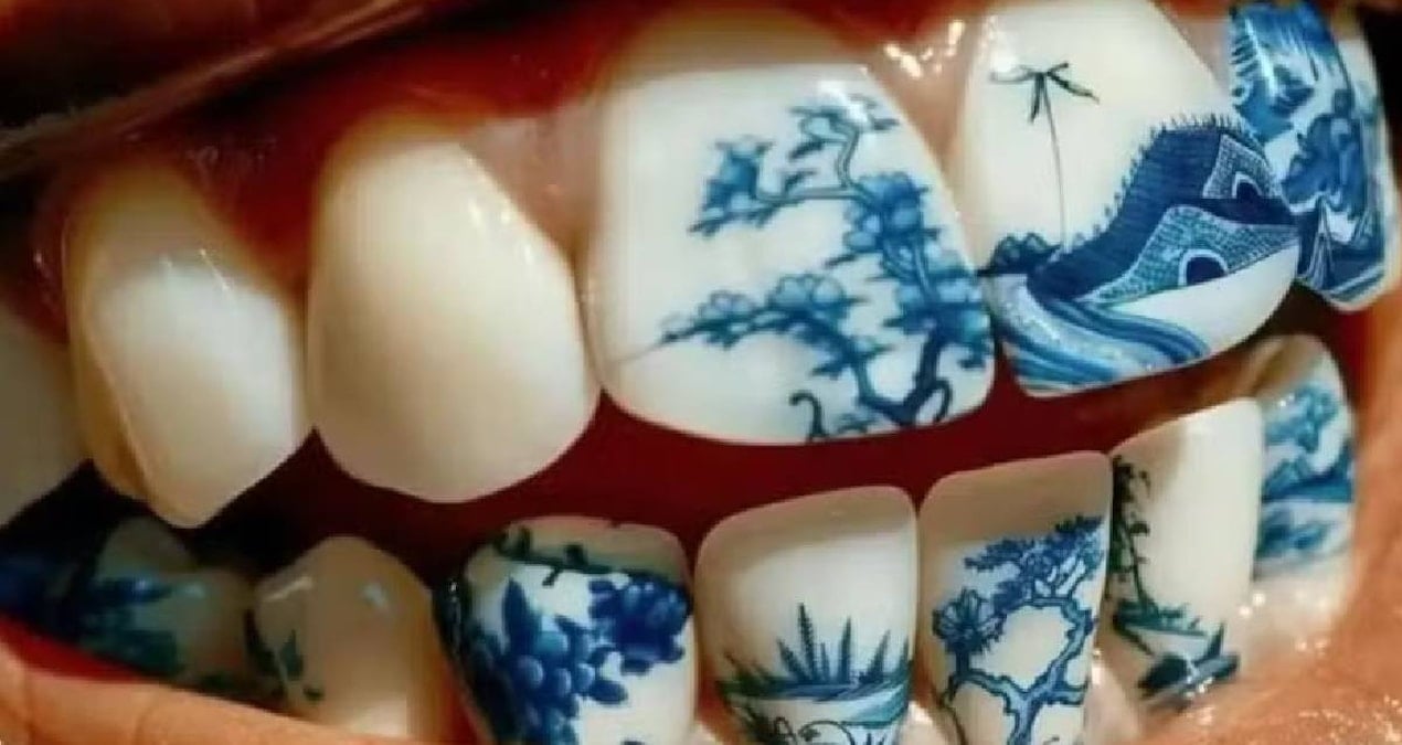 sonunda bu da oldu dis dovmeleri giderek yayginlasiyor wu6A7atf